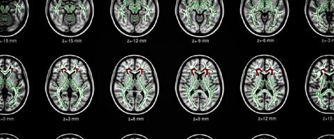 Brain scans, Journal of Wild Culture, ©2015